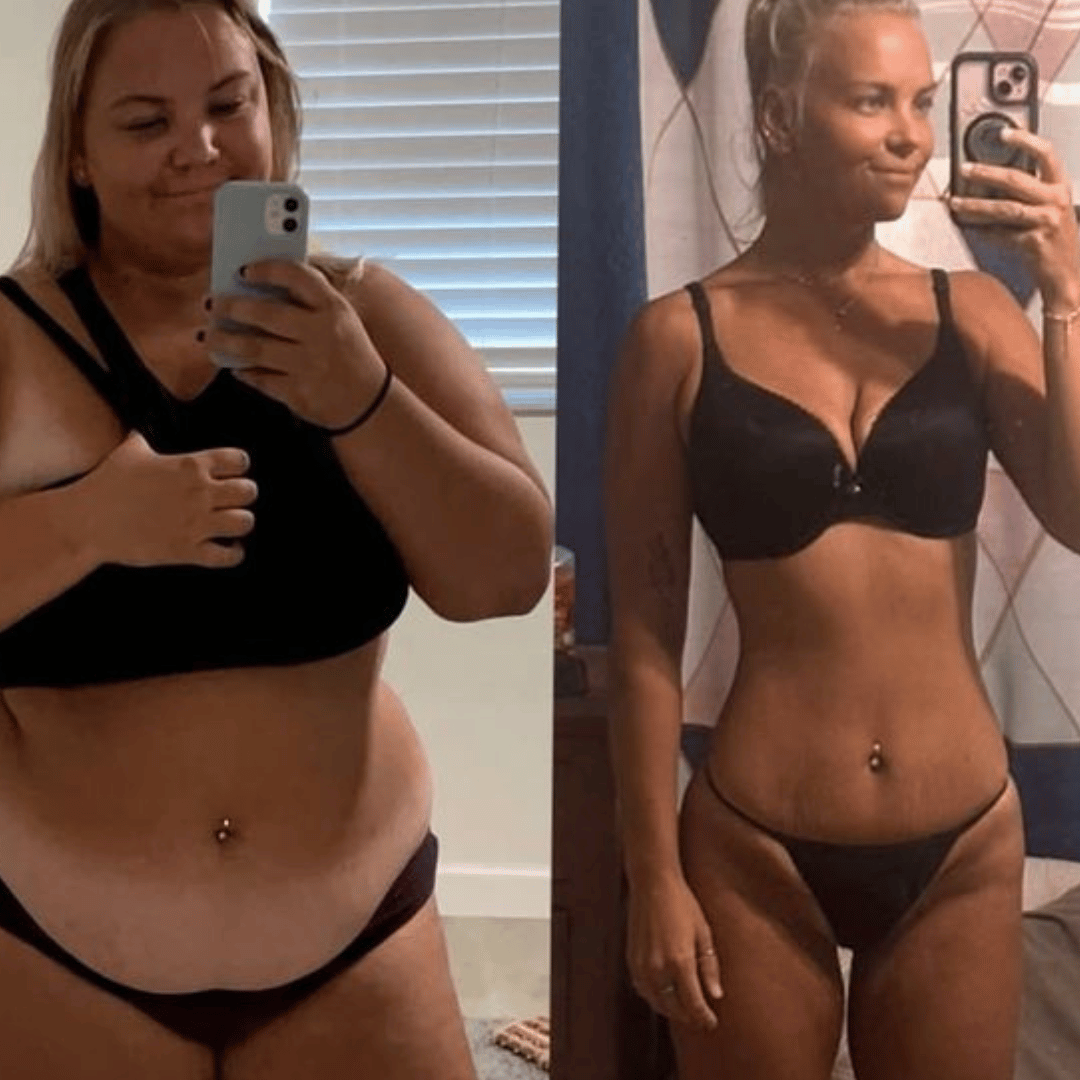 Parches GLP Belavis®