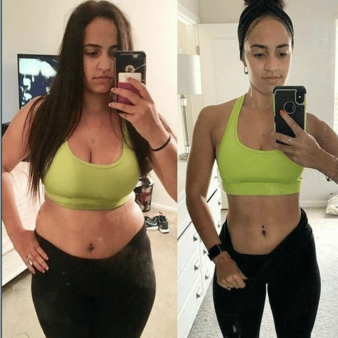 Parches GLP Belavis®